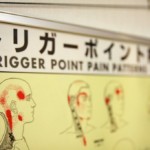triggerpoint