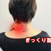 ぎっくり首